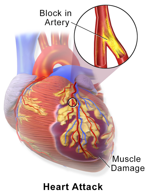 Does Selenium Reduce the Risk of Heart Disease? 