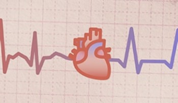 Atrial Fibrillation