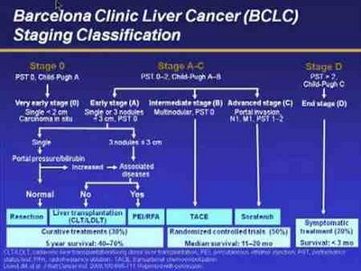 Signs That Liver Failure May Exist