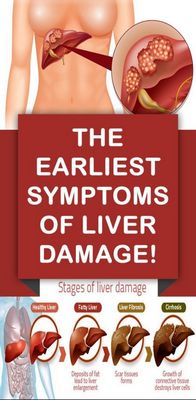 Symptoms of Liver Disease