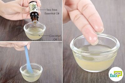 Using Tea Tree Oil to Treat Jock Itch