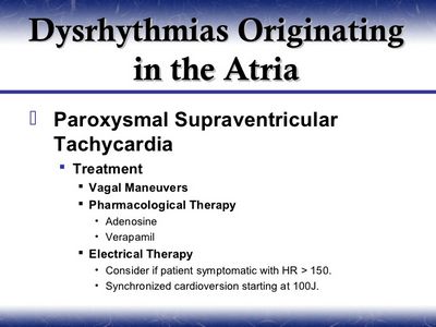 What Are the Symptoms of Paroxysmal Arrhythmia?