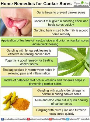 Best Home Remedies for Canker Sores